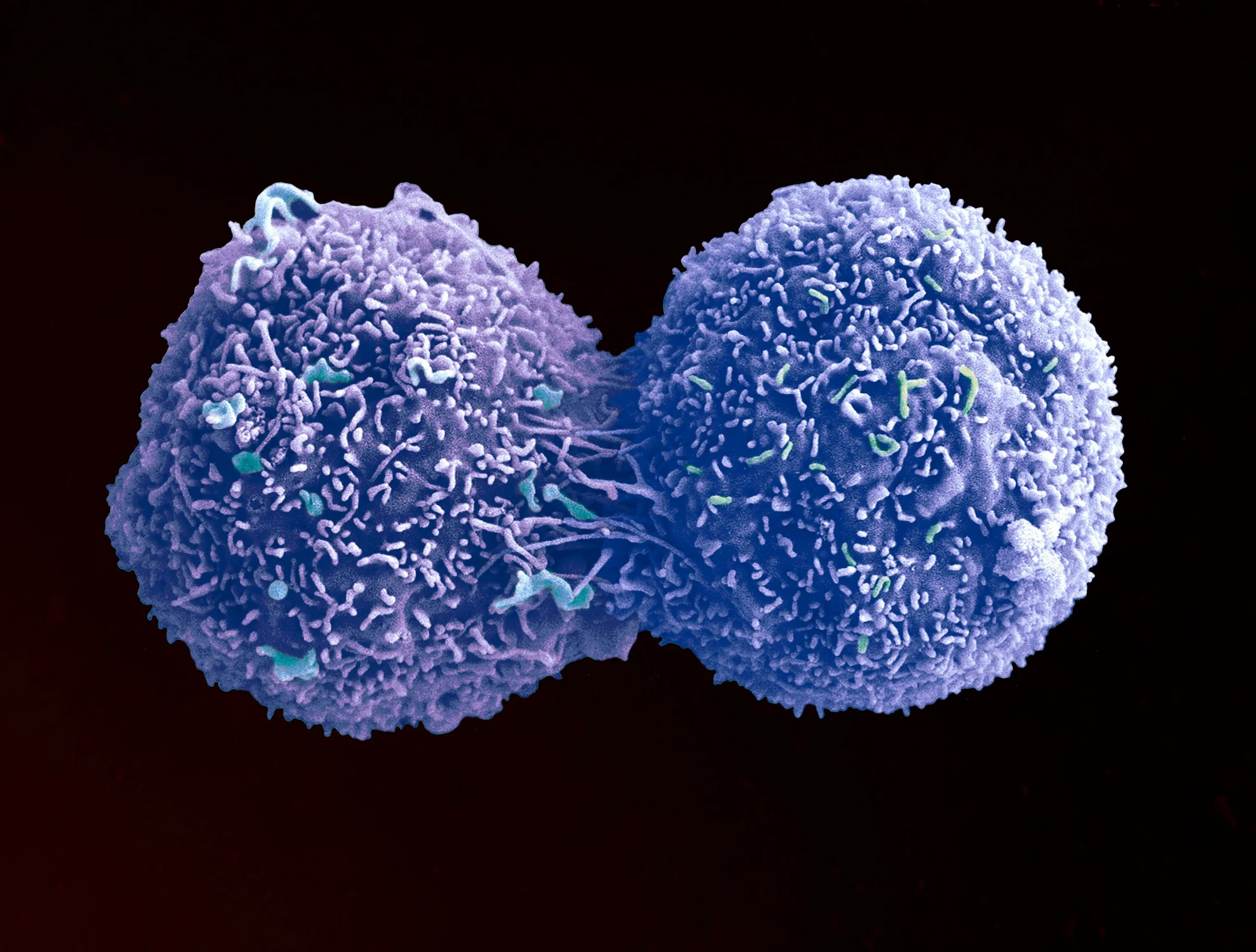 Опухолевые клетки. Деление раковых клеток. Ген-супрессор опухолей. Злокачественные клетки. Питание раковой клетки