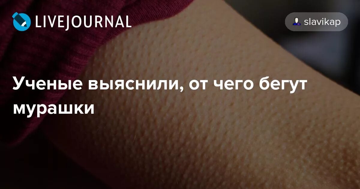 Мурашки бегают по телу. Ползание мурашек по коже. Причины мурашек по телу. Частые мурашки по телу.