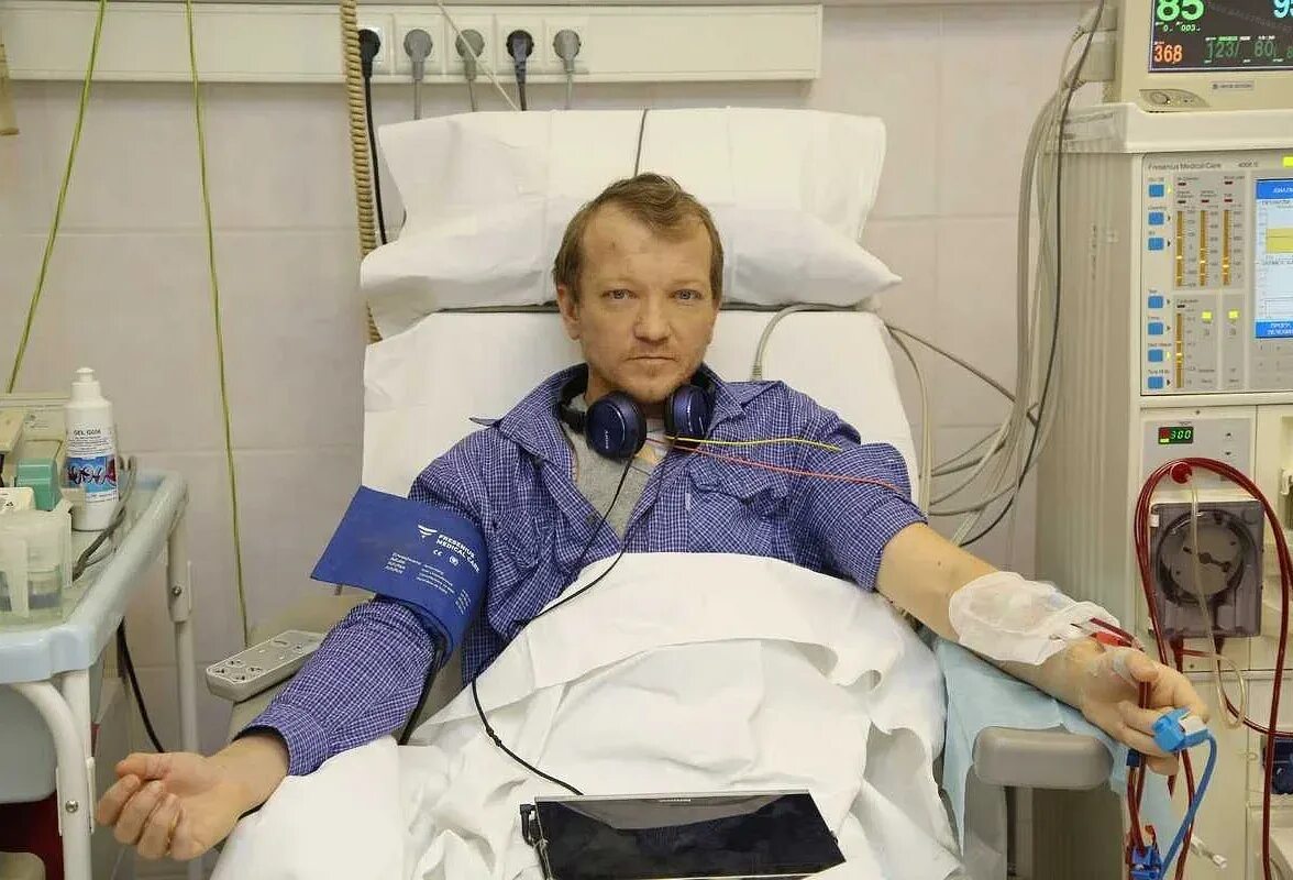 Если отказывают почки сколько человек может прожить. Больной с почечной недостаточностью. пациент с почечной недостаточностью. лицо больного с почечной недостаточностью. человек с больными почками.