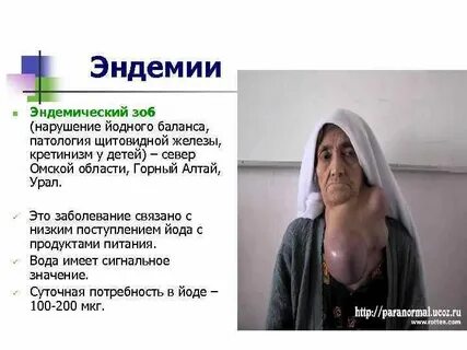 Эндемия