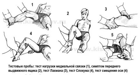 Симптом выдвижного ящика