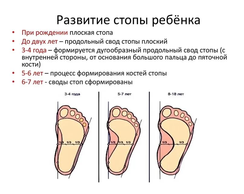 Нога имеет плоскую ползательную подошву. Плоскостопие у ребенка 3 года стопа. Формирование стопы у ребенка. Плоская стопа у ребенка 5 лет. Плоскостопие 2-3 степени вальгус.