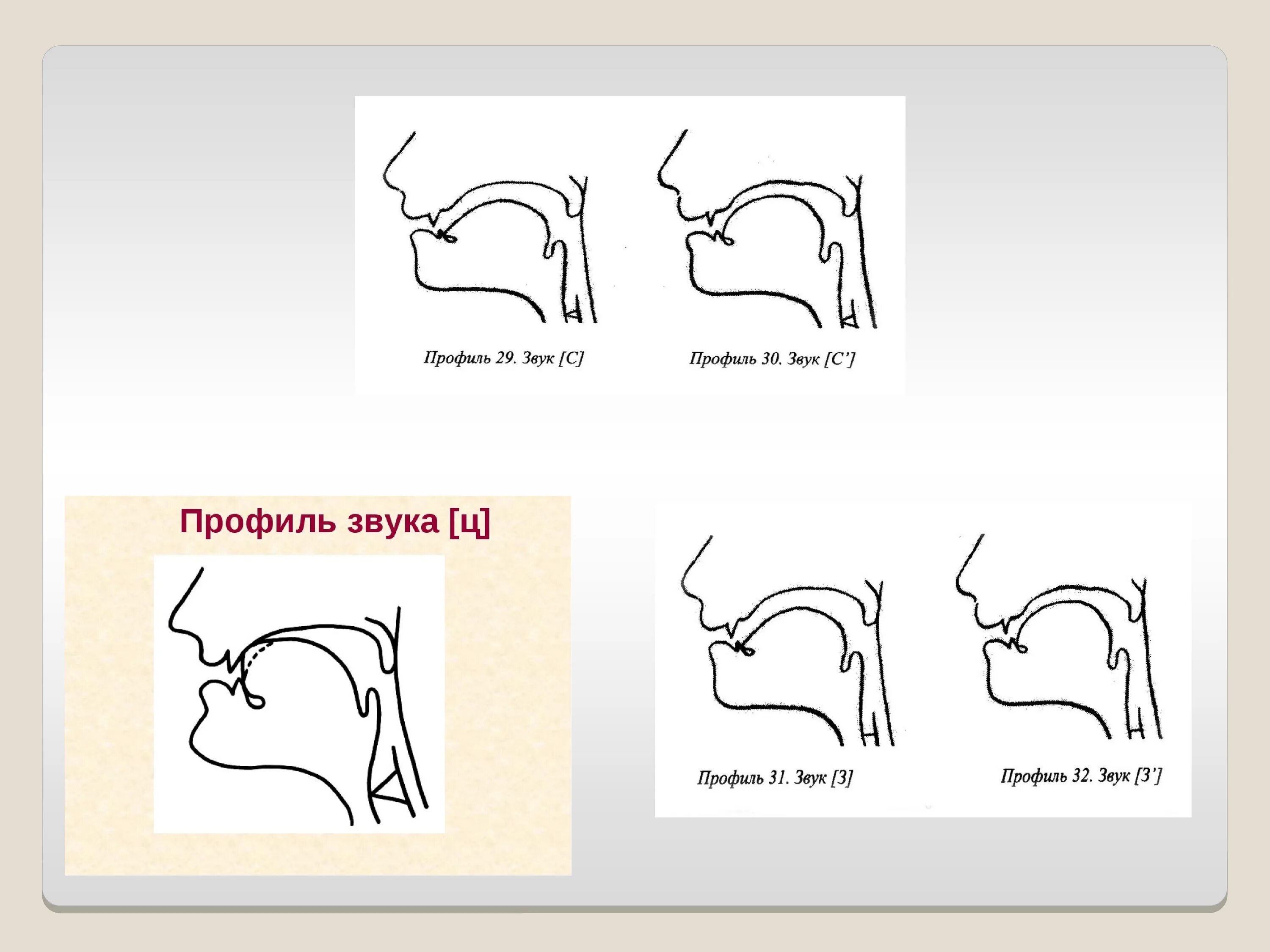 Профили артикуляции свистящих звуков. Сигматизм свистящих профиль. Профили свистящих звуков при ринолалии. Профили артикуляции свистящих звуков. С З. Профиль артикуляции