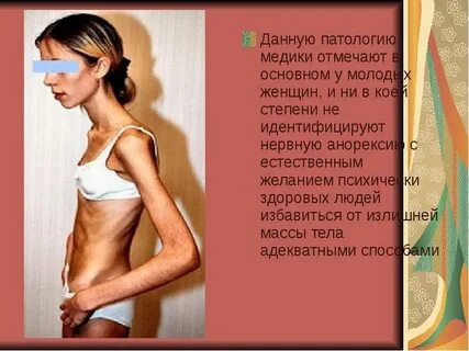 Анорексия что это такое простыми