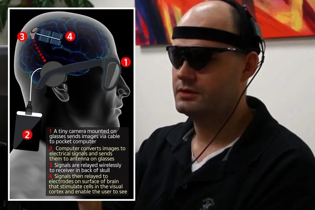 Глаз смотрит мозг видит. Очки которые позволяют видеть слепым. Кортикальный зрительный имплант. Видеть мозгом.