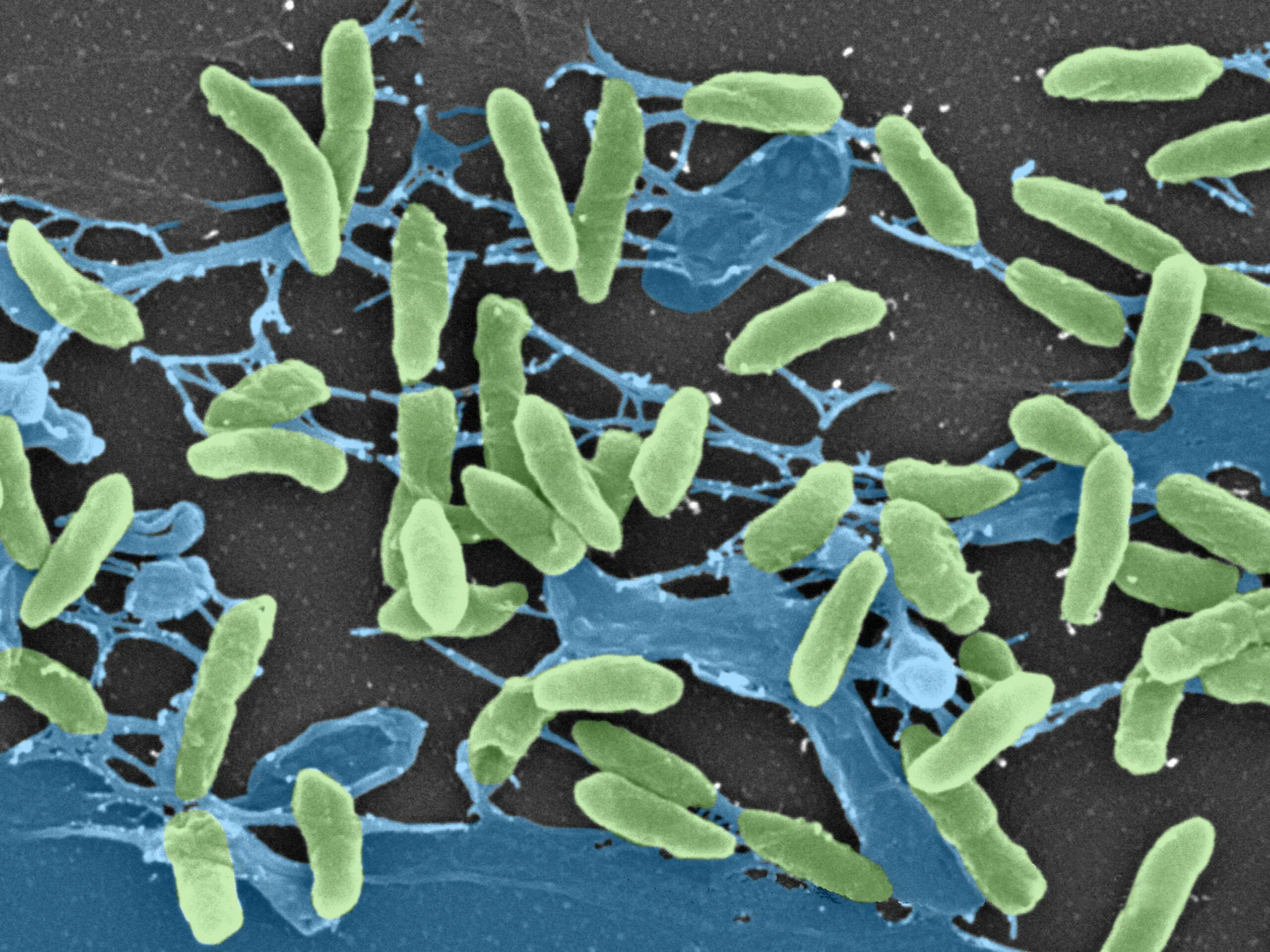 Гнилостные бактерии питание. Псевдомонас аэругиноза. Pseudomonas aeruginosa микробиология. Бактерии рода Pseudomonas. Псевдомонады 1.