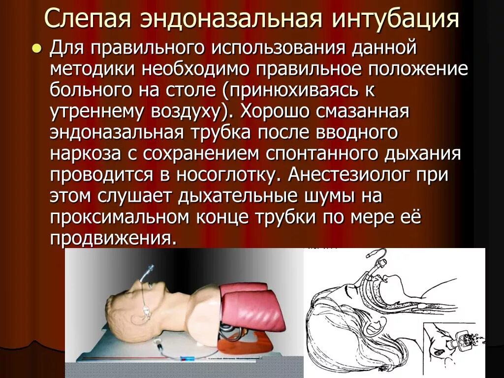 Прием при интубации. Интубация трахеи наркоз. положение пациента для интубации. положение для интубации трахеи. положение пациента при интубации трахеи.