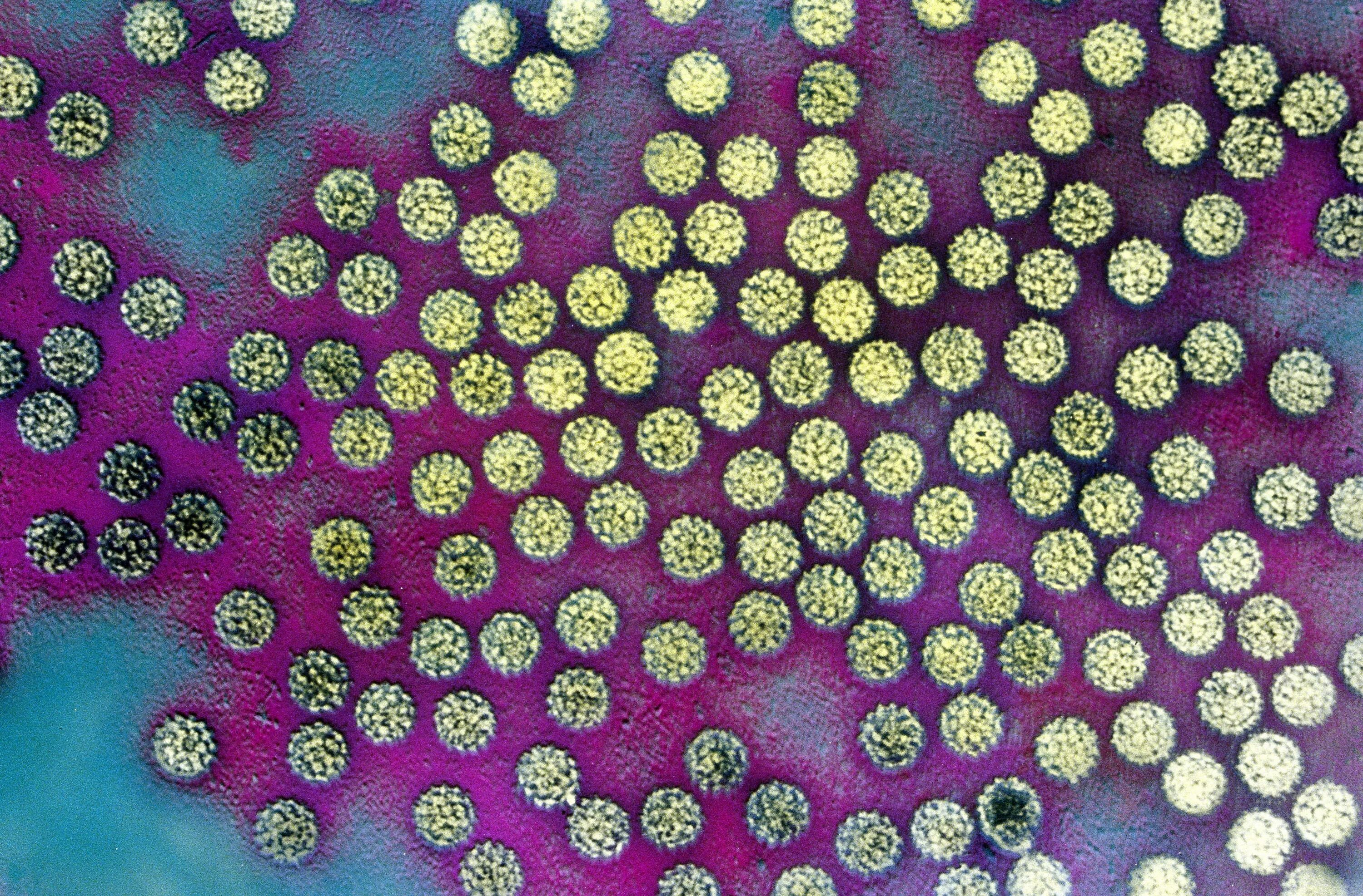 впч гепатит. впч гепатит. впч гепатит. папиломо-вирусной инфекции это. папилломавирус под микроскопом.