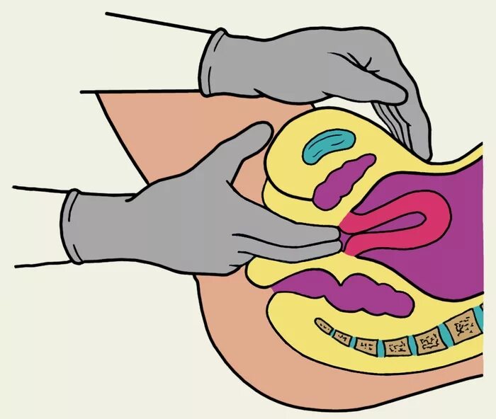 Женское ректальное. Двуручное обследование бимануальное. Бимануальное влагалищное исследование исследование. Бимануальное исследование шейки матки. Двуручное влагалищное исследование (бимануальное)..
