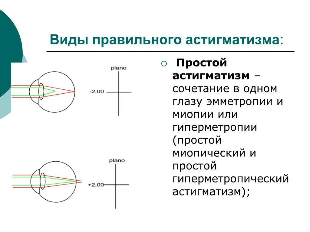 Сложный гиперметропический астигматизм глаз. Простой прямой миопический астигматизм. Гиперметропический астигматизм 2. Астигматизм миопический простой обратный. Сложный миопический обратный астигматизм.