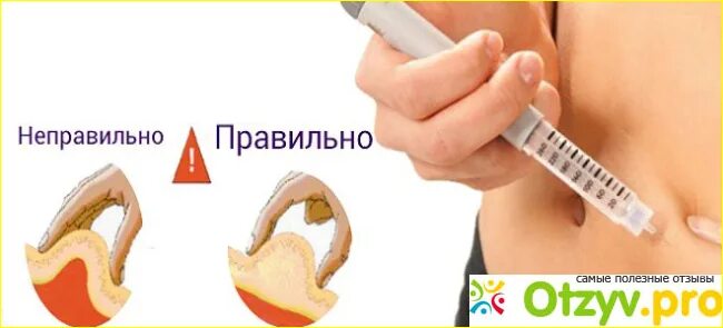 Как ставить клексан в живот. Укол подкожно в живот. подкожная инъекция в живот клексан.