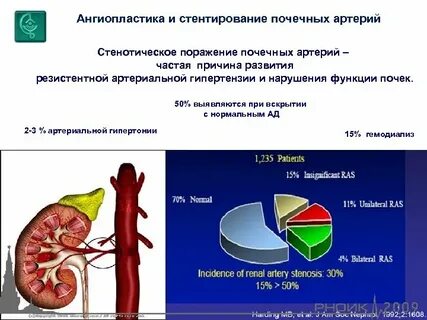 Давление после стентирования