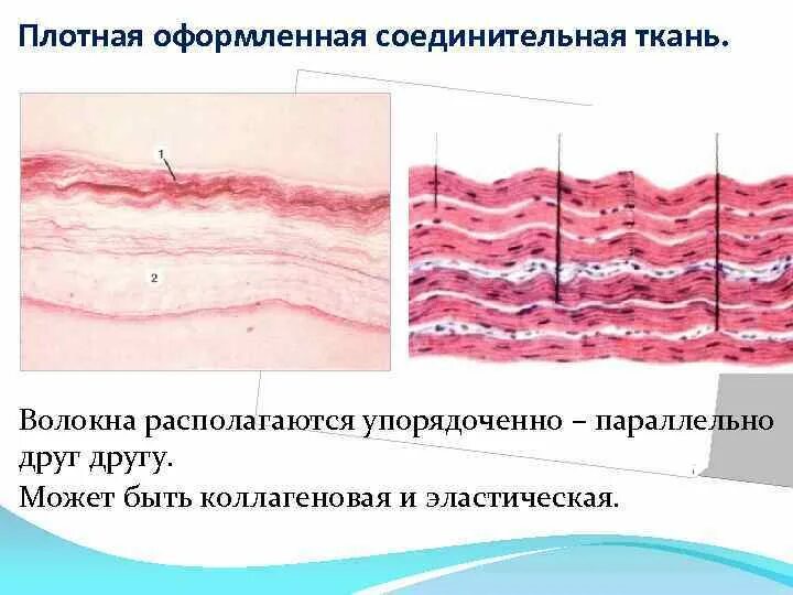 Плотная оформленная ткань. Плотная неоформленная соединительная ткань гистология. Плотная волокнистая соединительная ткань гистология. Плотная оформленная волокнистая соединительная ткань. Плотная волокнистая соединительная ткань коллаген.