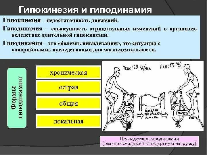 Какое воздействие оказывает гиподинамия низкая двигательная. Гипокинезия и гиподинамия. Понятие о гипокинезии и гиподинамии. Гипокинезия и гиподинамия причины. Влияние гипокинезии и гиподинамии на организм..