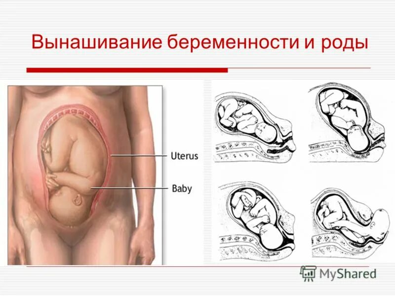 Схема рождения ребенка показать Top 10 cardinal movements of labor ideas and inspiration
