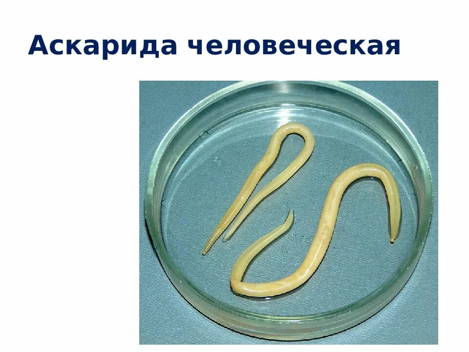 Аскарида класс. Круглые черви аскарида человеческая. круглый червь человеческая аскарида. аскариды острицы нематоды. круглые глисты острицы.