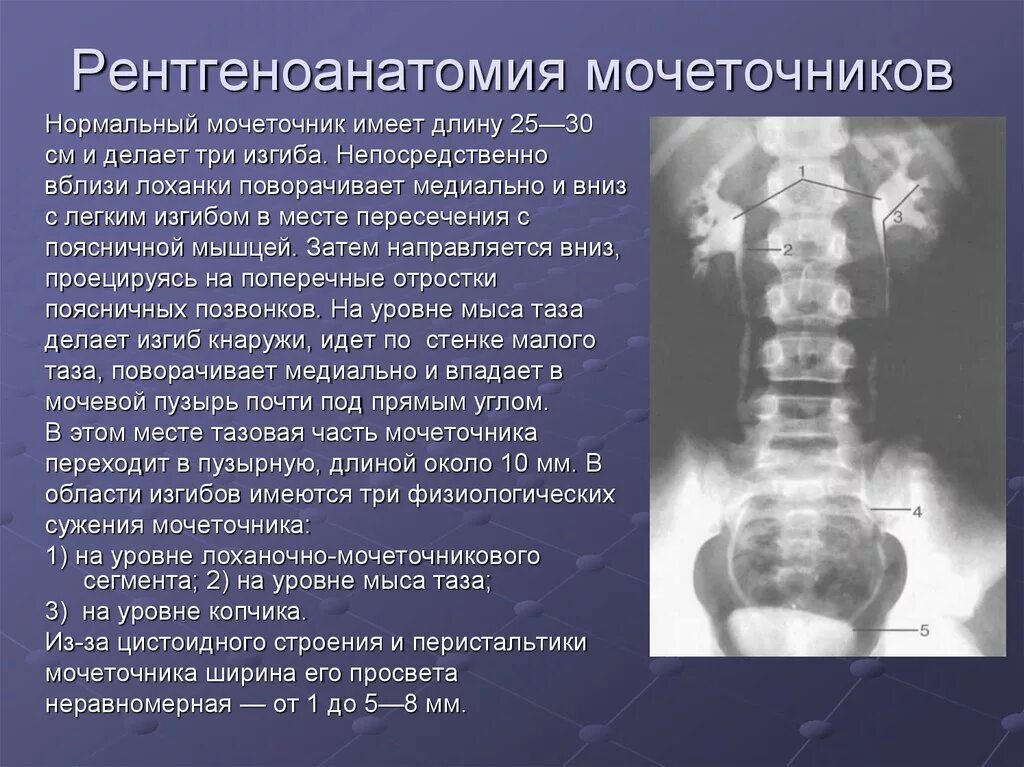 Уровни мочеточника. Рентгеноанатомия мочеточника. Мочеточник рентген анатомия. Сегменты мочеточника рентгеноанатомия. Рентгеноанатомия почек.