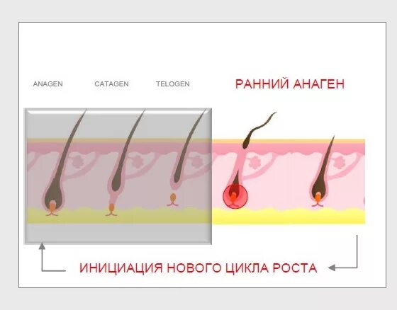 Стадии роста волос. Цикл роста волос. Стадия анагена роста волос. Рост нового волоса. Рост волоса происходит за счет