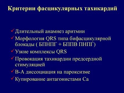 Лечение желудочковой тахикардии