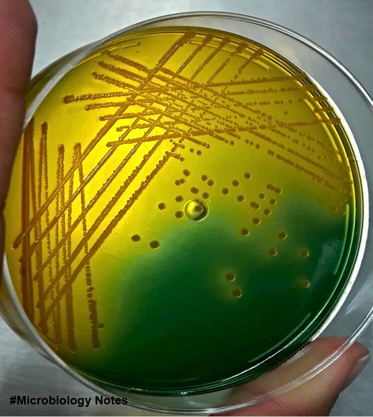 Бактерии в жидкой среде. Холерный вибрион на питательных средах. Холерный вибрион на чашке Петри. TCBS агар холерный вибрион. Среда TCBS микробиология.