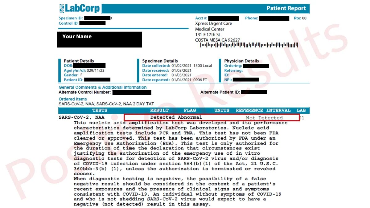 Регистр covid 19 вход. Covid Test Result. Negative PCR Covid Test Results. LABCORP negative Covid Test. Positive Covid Test Results.