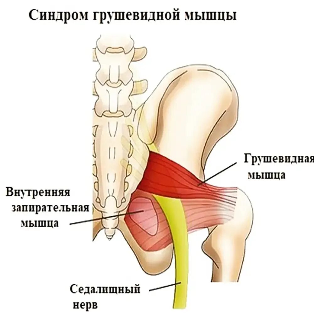 Мышца седалищного нерва. Грушевидная мышца и седалищный нерв. Грушевидный синдром тазобедренного сустава. Грушевидная мышца анатомия. Грушевидная мышца анатомия человека.