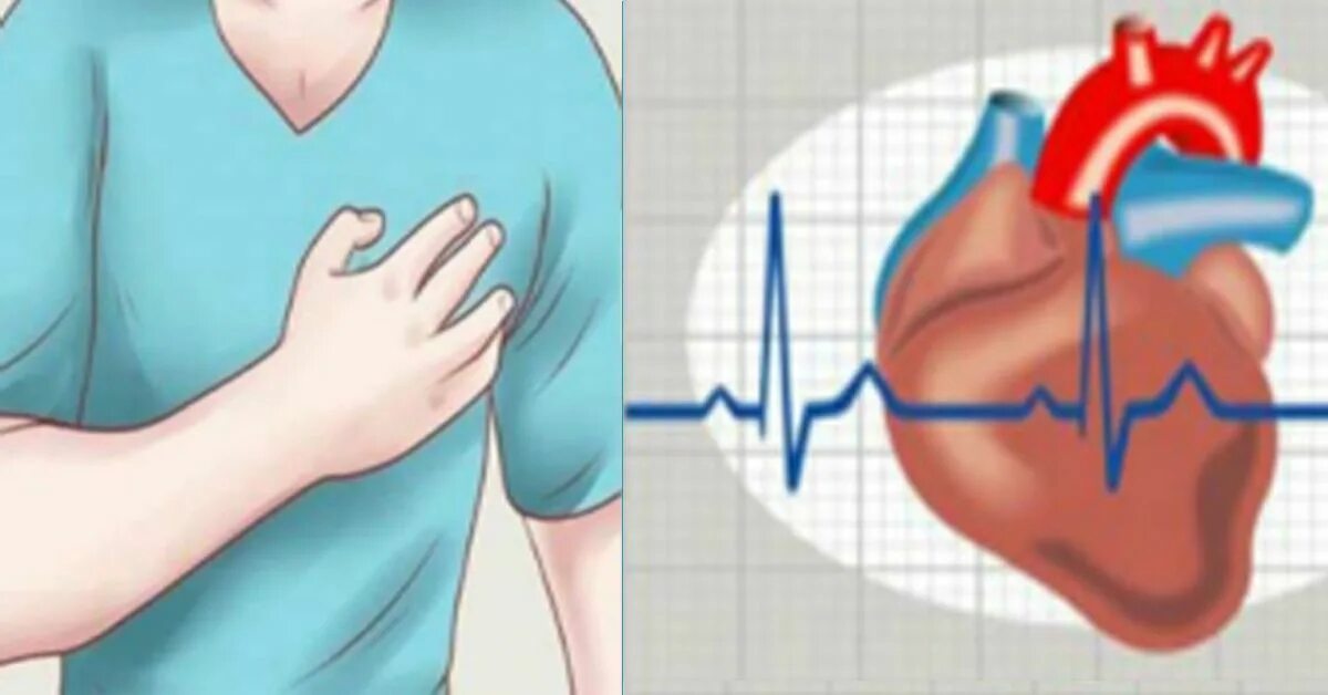 Сердце учащенное сердцебиение. Приступы сердцебиения. Тахикардия картинки. Тахикардия сердца. Приступ тахикардии.