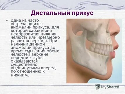 Почему болит нижняя челюсть