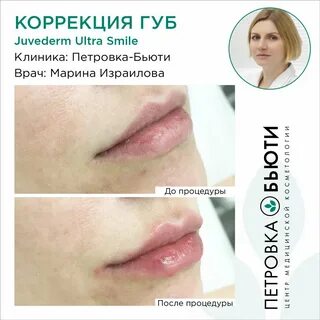 Смайл отзывы