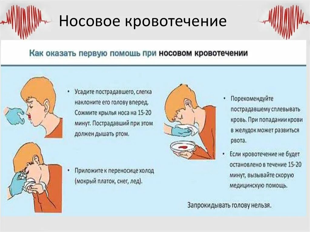 При носовом кровотечении необходимо выполнить. При носовом кровотечении у детей. Носовые кровотечения у детей причины. Почему идёт кровь из носа.