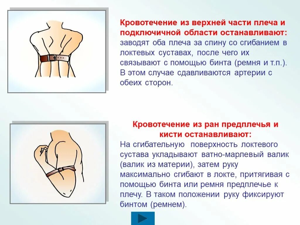 Остановка артериального кровотечения из верхней трети плеча. Остановка кровотечения из плечевой артерии. Остановка кровотечения в верхней трети плеча. Способы остановки артериального кровотечения из плечевой артерии.