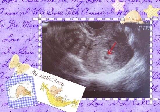 4 недели беременности узи 4 недели беременности. Узи 2 недели беременности. 4 недели беременности узи. 4 недели беременности как выглядит на узи. 4 недели беременности как выглядит на узи.