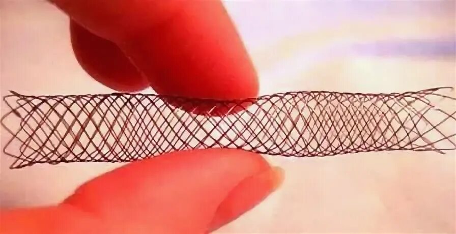 Стентирование пищевода рентген. Стентирование трахеи у собак. Стент трахеальный для собак. Т-образный силиконовый стент. Стентирование трахеи.