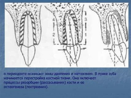 Изменения в кости зуба