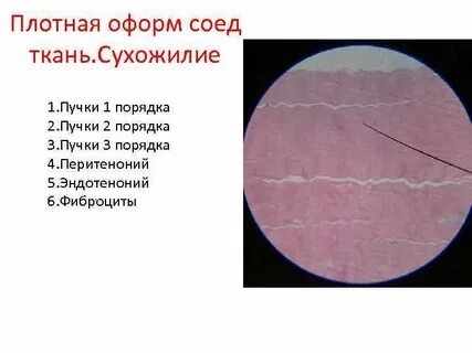 Перитеноний