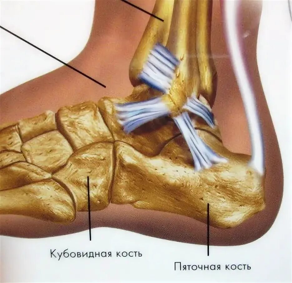 Болезнь пяточной кости у детей