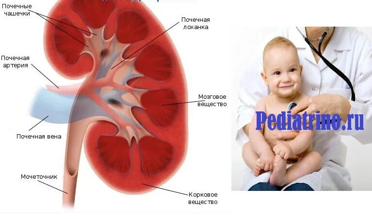 Вторичный пиелонефрит у детей. Пиелонефрит педиатрия. Пиелонефрит у новорожденных детей. Пиелонефрит у детей до года. Клиника пиелонефрита у детей.