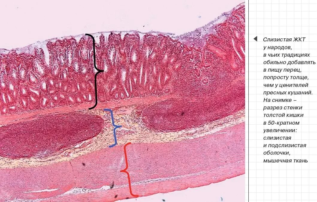 Подслизистый слой пищевода. Эпителий Толстого кишечника гистология. Препарат толстой кишки гистология. Стенка толстой кишки гистология. Эпителий тонкой кишки гистология.