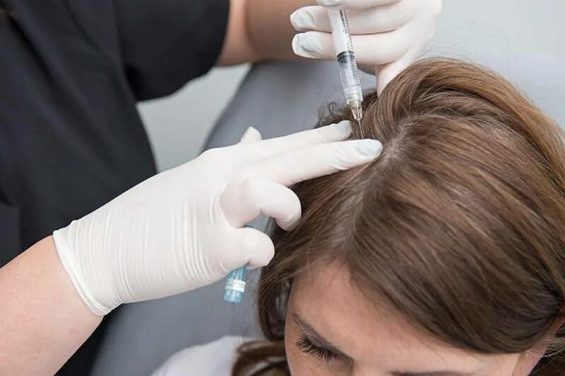 Инъекции головы. Hair treatment мезотерапия. PRP плазмотерапия для волос. Mesotherapy for hair. Мезотерапия для волос.