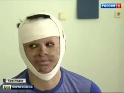 Хирург пришил лицо