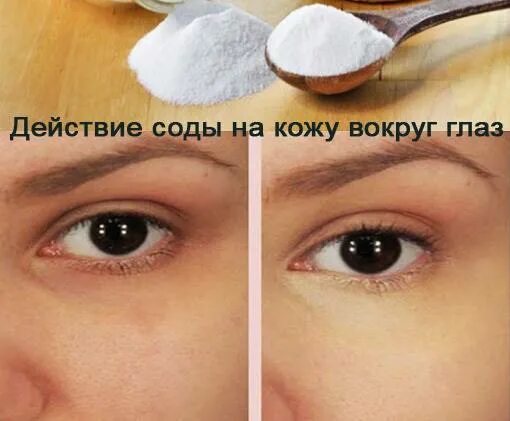 Как избавиться от синяка за один день. Убирание синяков под глазами. избавление от синяков под глазами. примочки от синяков под глазами. как избавиться от синяков под глазами.