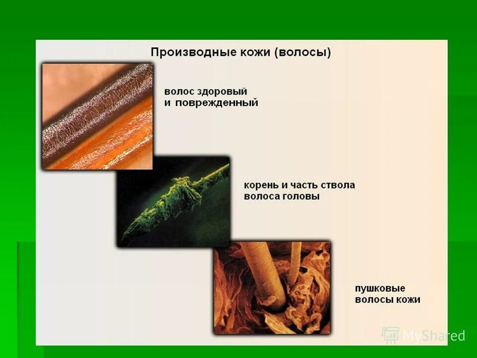 строение кожи потовая железа. производные кожи строение. производные кожи анатомия. железы кожи. производные кожи волосы ногти.