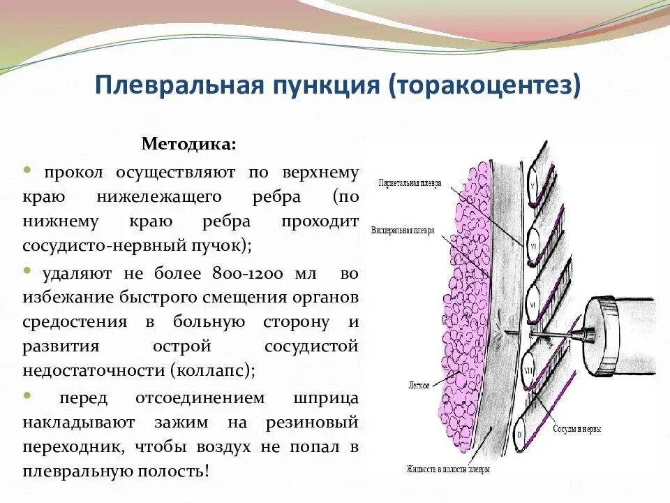 Методика пункции плевральной полости. Пункция плевральной полости схема. Показания для диагностической плевральной пункции. Показания к пункции плевральной полости.