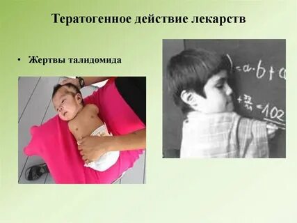 Тератогенное действие