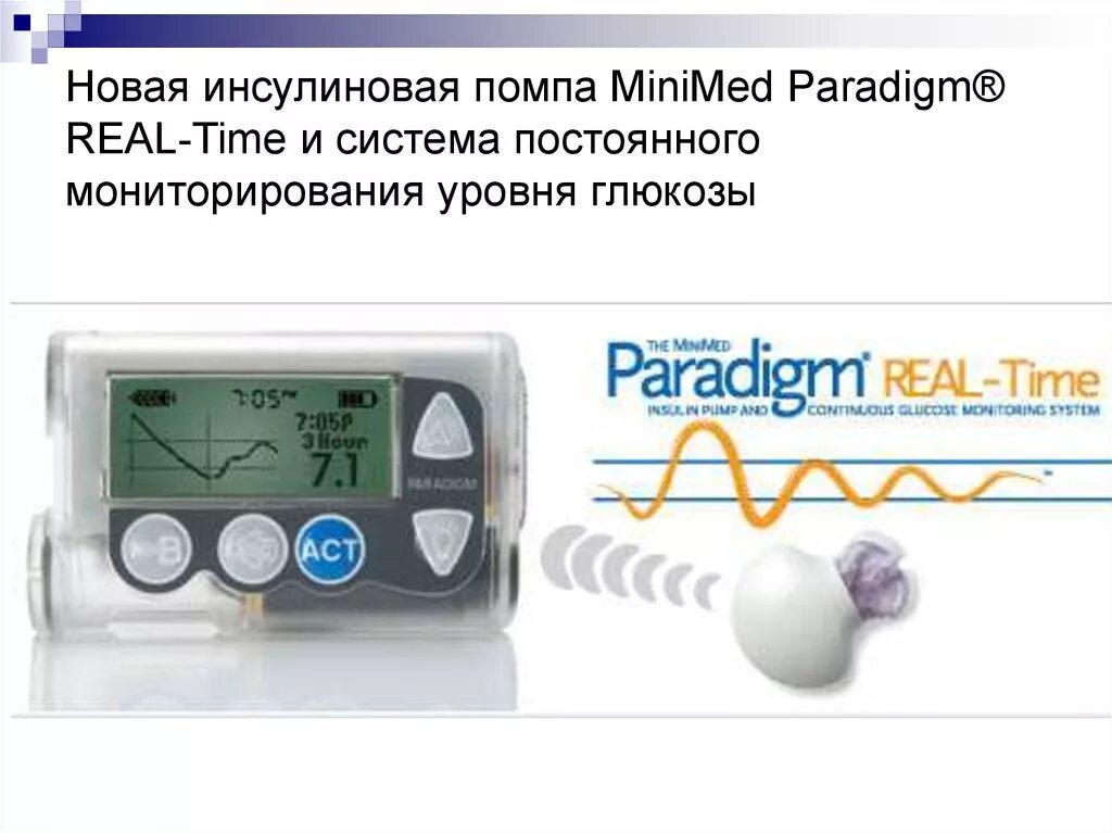 Принцип инсулиновой помпы