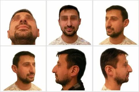 Nose am