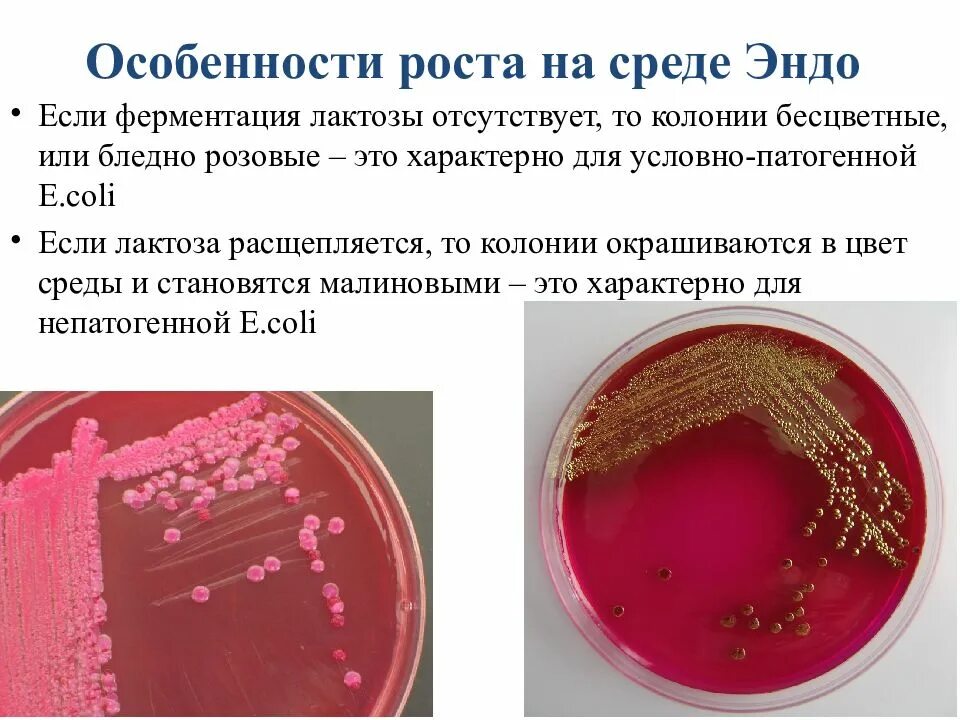 Кишечные палочки на Эндо палочки. Кишечная палочка на среде Эндо. Рост колоний на среде Эндо. E coli на Эндо рост колонии. Свойства кишечной палочки