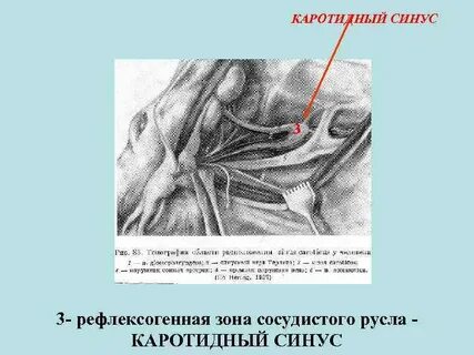 Каротидный синус