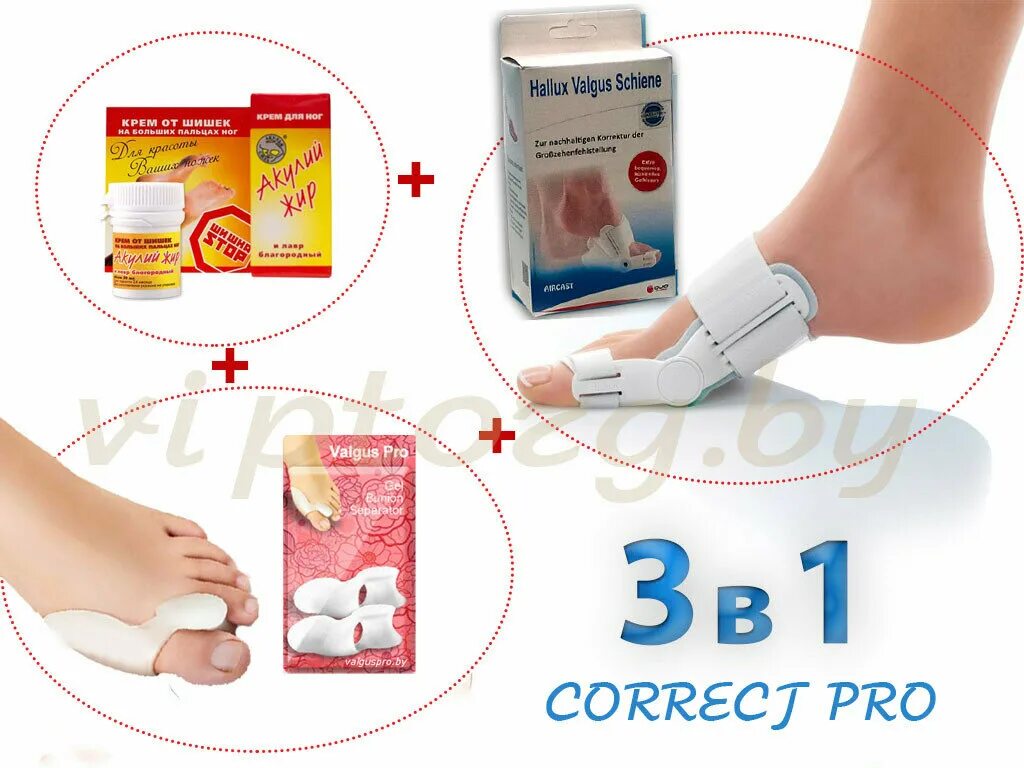 Anyone ортопедический набор. крем от шишек на ногах. крем от вальгусной косточки. Correct pro. Correct pro.