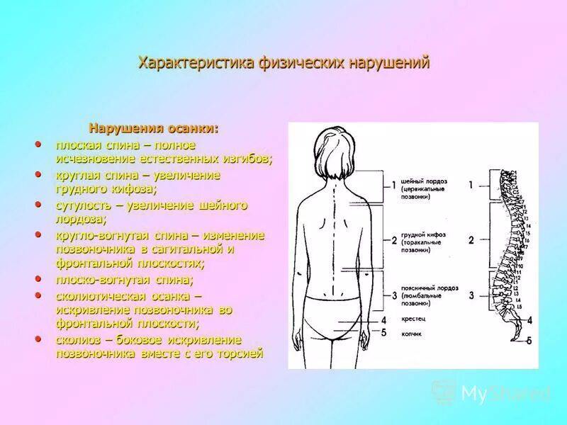 характеристика осанки человека. профилактика искривления осанки. нормальная осанка. характеристика нарушения осанки. осанка и искривление позвоночника.